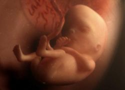 14 settimane di gravidanza - dimensione fetale