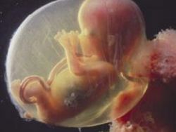 Dimensione gestazionale di 17 settimane del feto