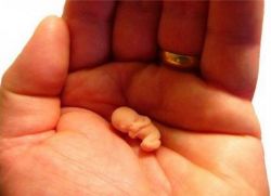 Dimensione gestazionale di 9 settimane del feto