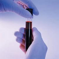 Ujian darah untuk kehamilan