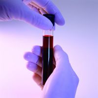 analisis antibodi darah kepada TPO meningkat
