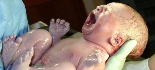 klasifikasi asfiksia bayi baru lahir