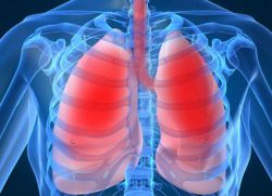 atelettasia del polmone