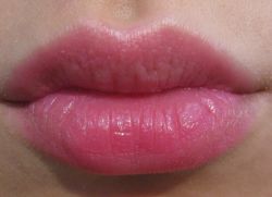 titik putih kecil di bibir