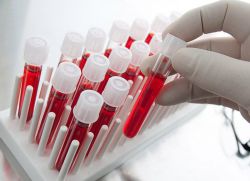 Apa yang menunjukkan hemoglobin glikosilasi