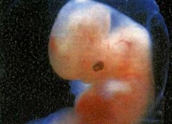 embrio 5 minggu