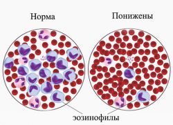 Ujian darah eosinophils diturunkan