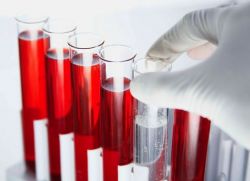 sangue biochimico test fibrinogeno norma