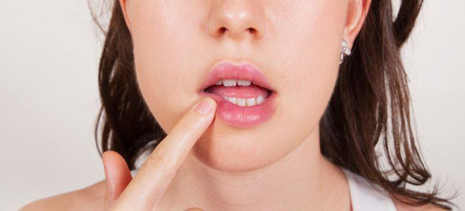 herpes dėl priežasčių lūpų