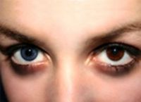 青い目で茶色のレンズを見る方法3