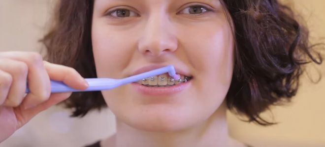 Bagaimana untuk memberus gigi anda dengan berus gigi