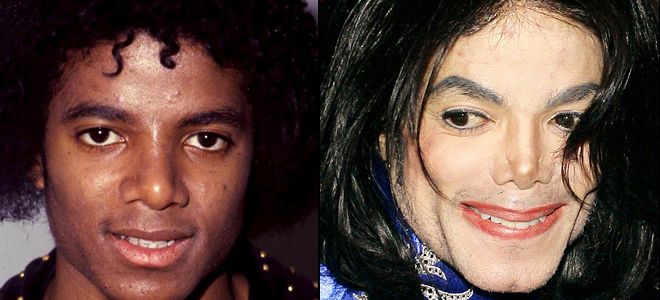 Как Майкл Джексон поменял цвет кожи