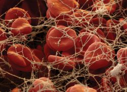 Platelet rendah dalam darah