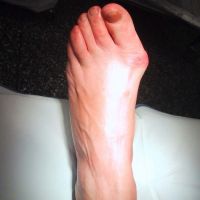 X-ray kaki dengan beban