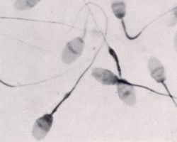 Komposisi kimia sperma