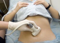 ultrasound dengan salur hidrokortison pada abdomen bawah