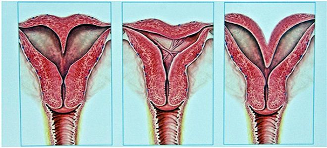 struktur rahim wanita